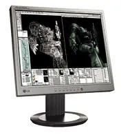 LG L2013P 20.1" TFT 16ms 0.255 Monitör Monitörle