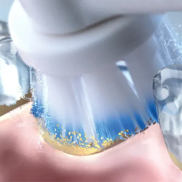 Oral-B SmartSeries Sensitive Yetişkin Döner diş fırçası Thumbnail 7